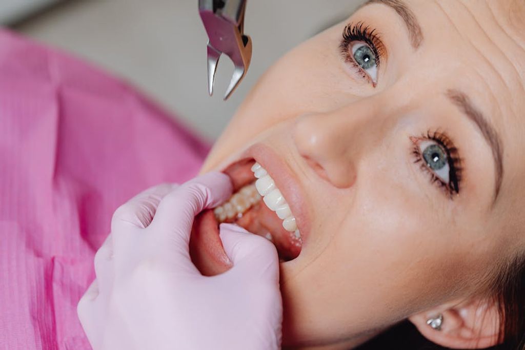 Karola G באתר PEXELS wisdom tooth extraction